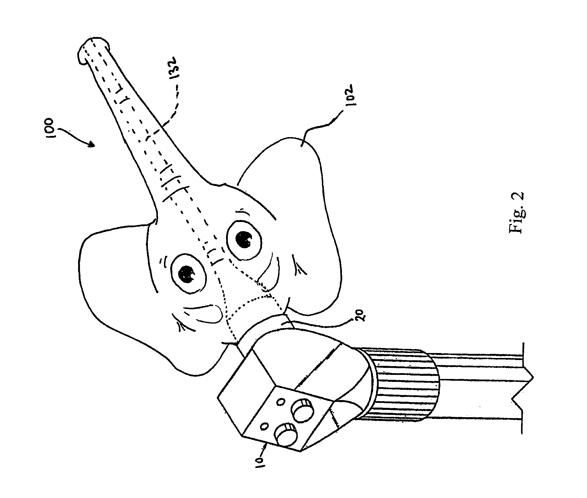 Systems and methods for providing a decorative dental tip