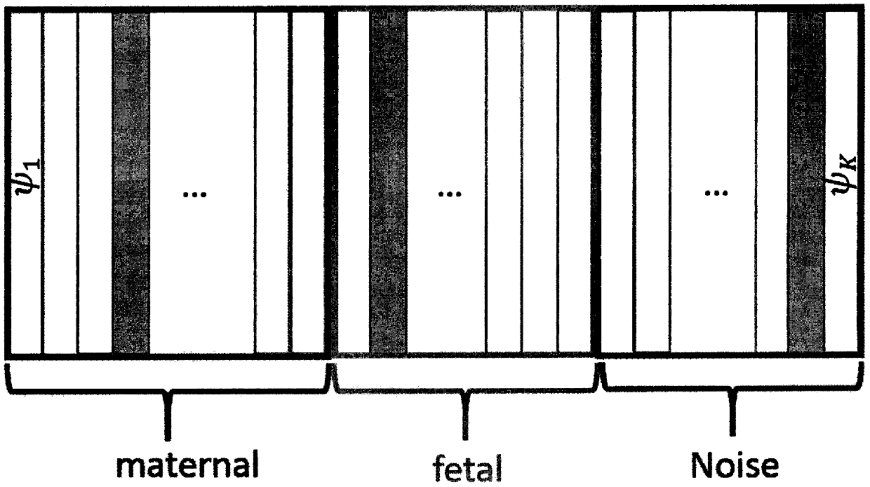 Method for detecting maternal electrocardiogram R peak on single-channel pregnant woman's abdominal wall myoelectricity