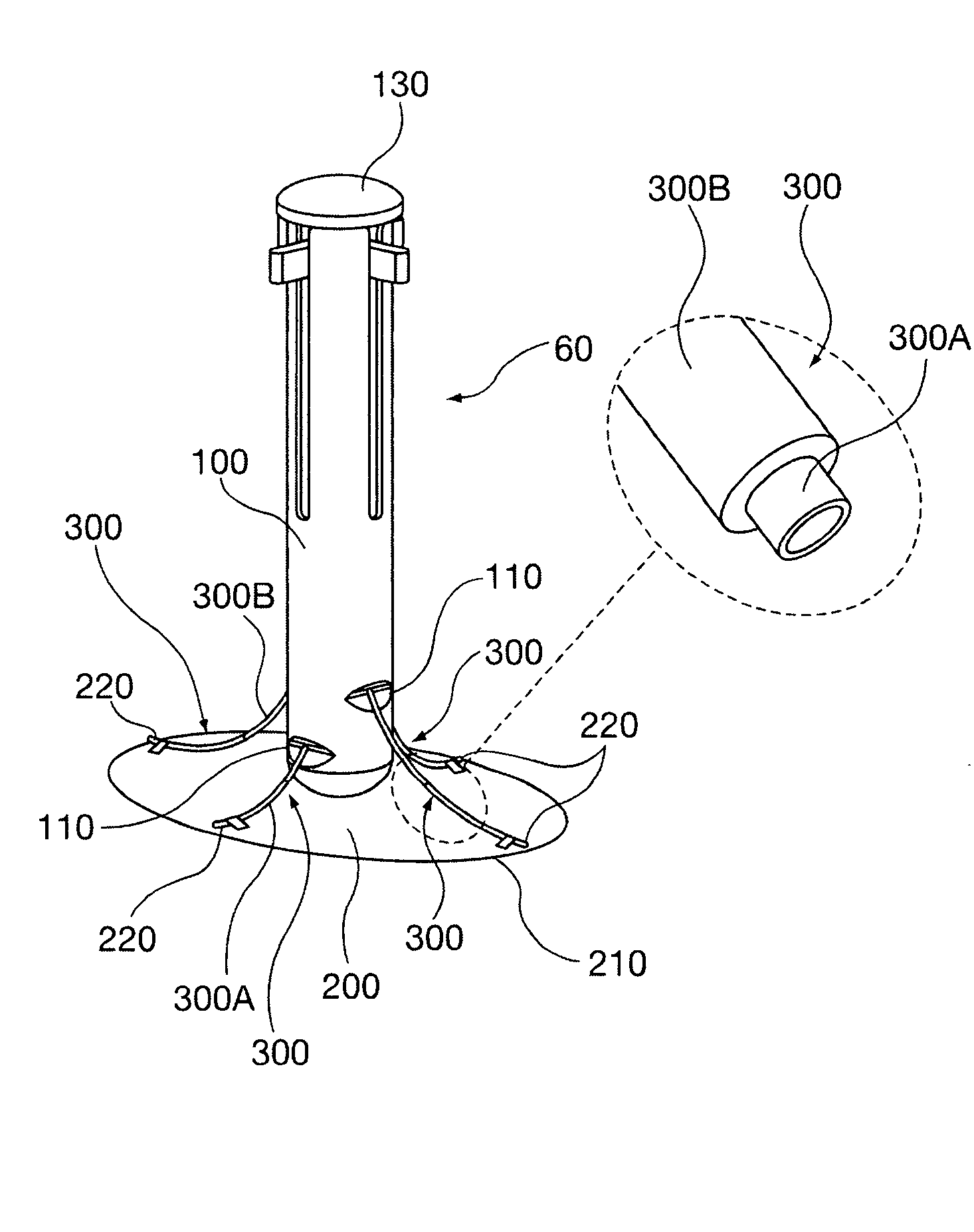Method and apparatus for minimally invasive delivery, tensioned deployment and fixation of secondary material prosthetic devices in patient body tissue, including hernia repair within the patient's herniation site