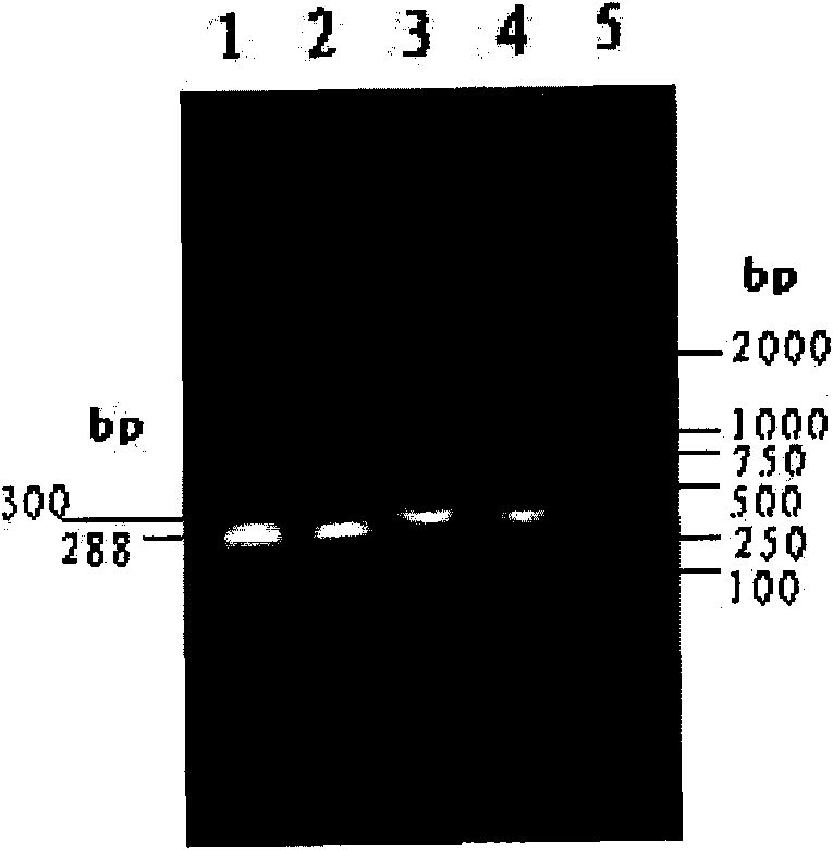 Recombinant protein for diagnosing bovine tuberculosis and application thereof