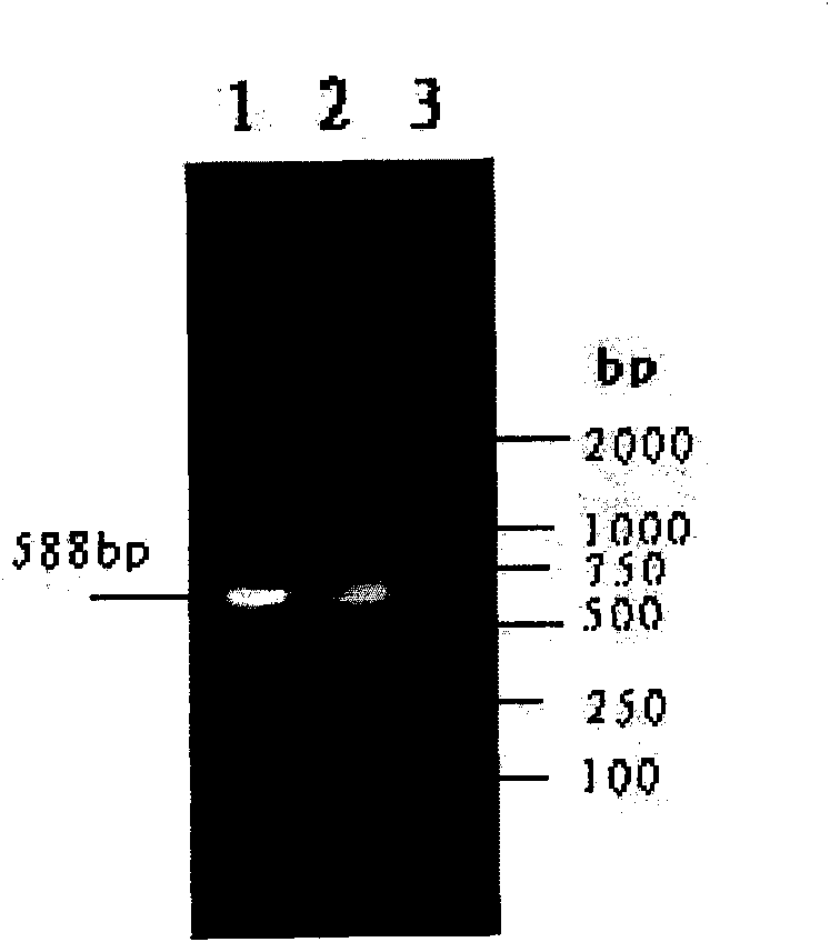 Recombinant protein for diagnosing bovine tuberculosis and application thereof