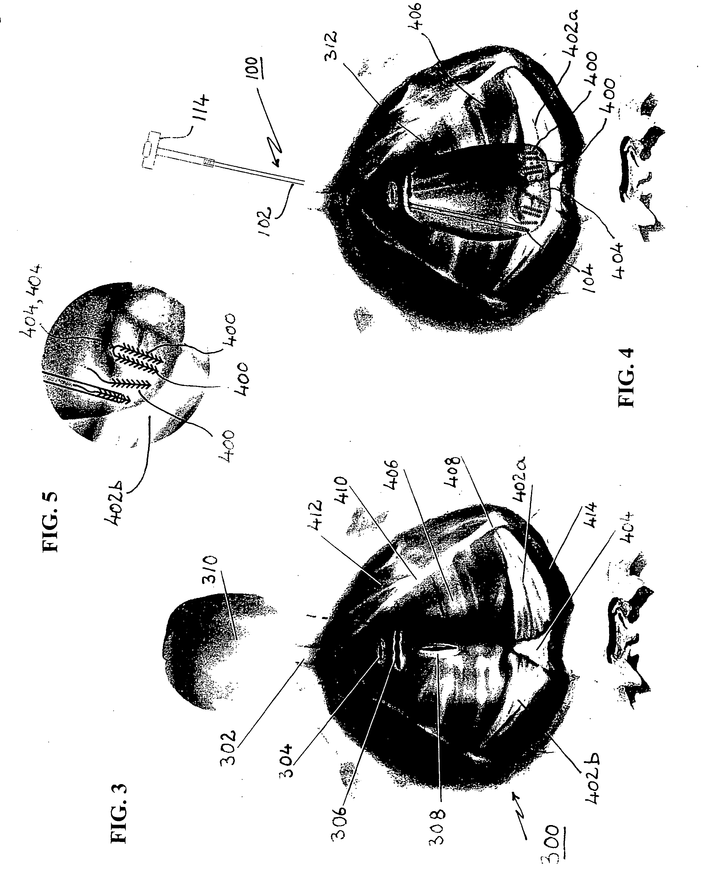 Apparatus and method for incision-free vaginal prolapse repair