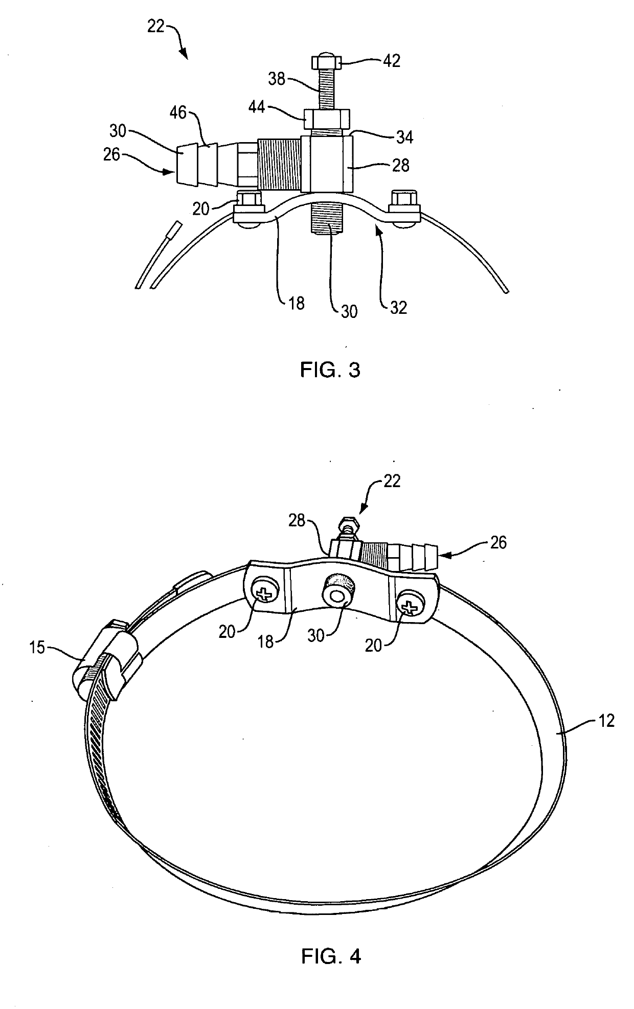 Fluid extractor device and kit