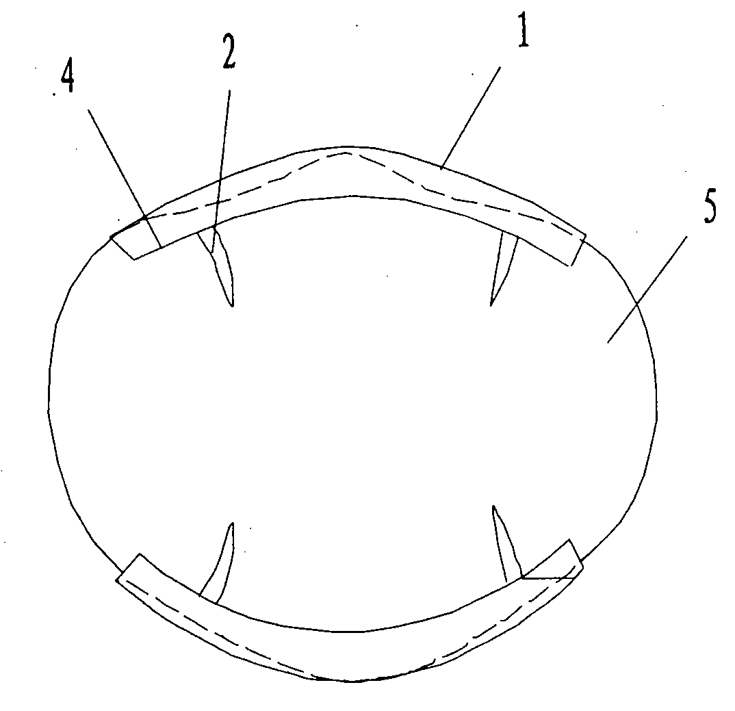 Encircling fixator for curing patella fracture