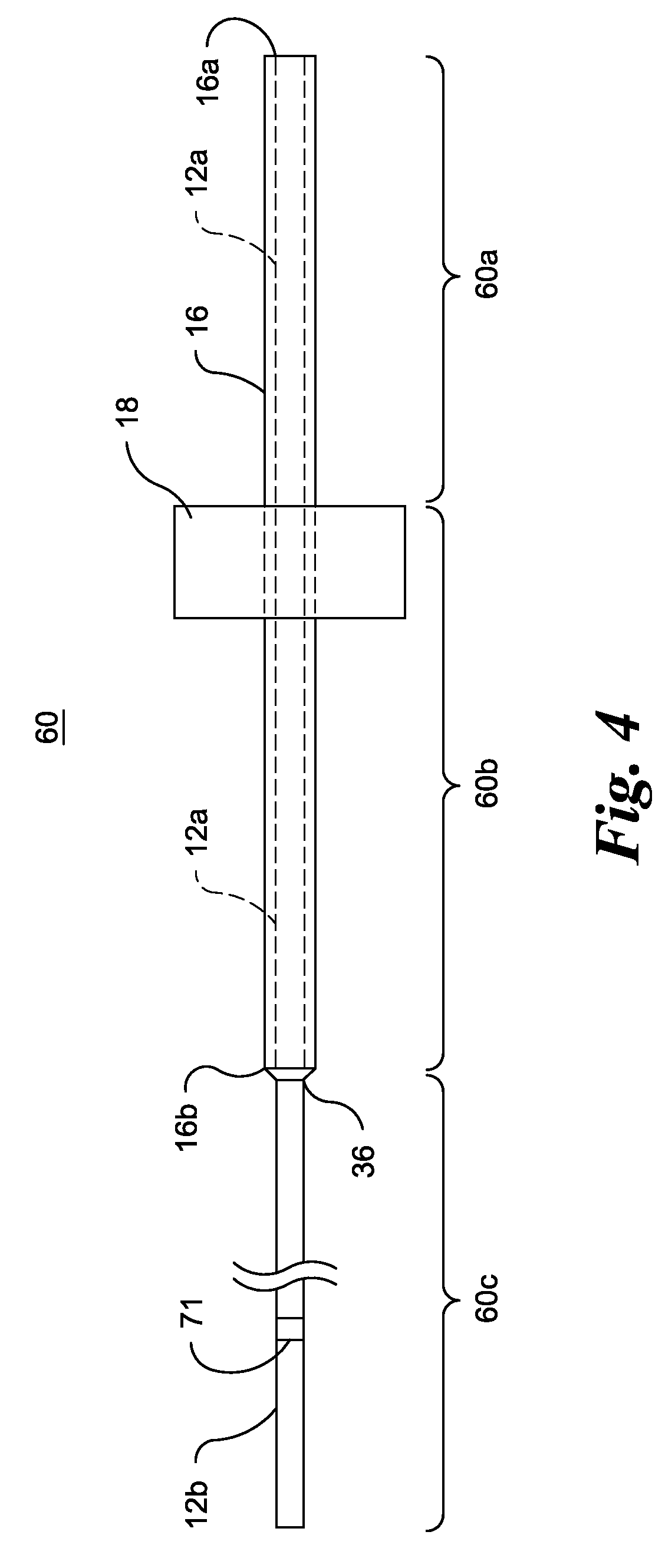 Apparatus and Method for Separating and Storing Human Reproductive Material in a Cryotank