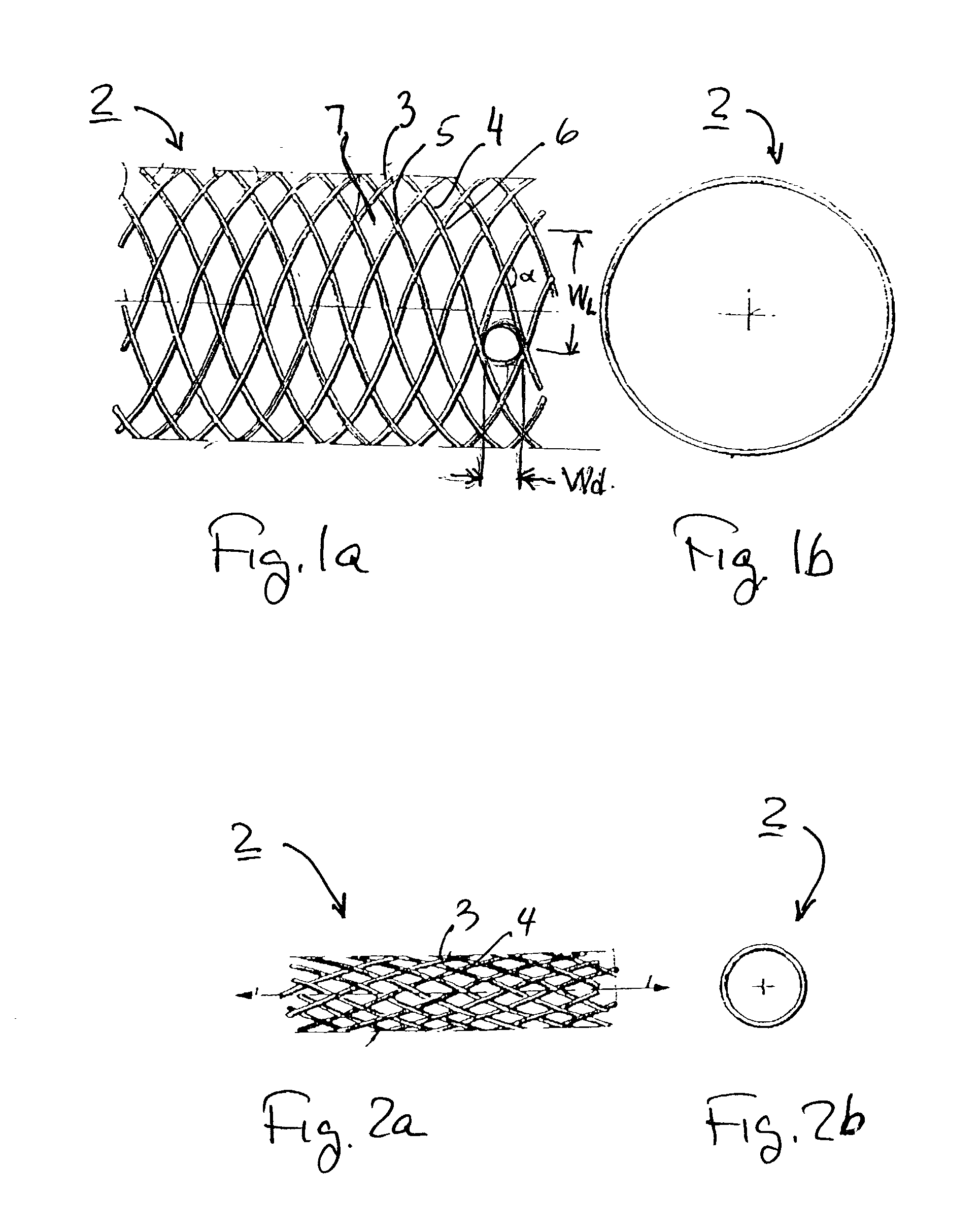 Implantable intraluminal device and method of using same in treating aneurysms