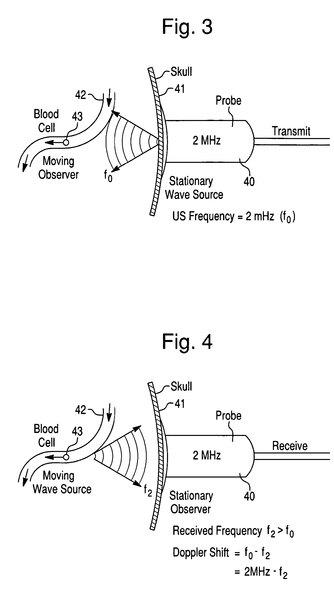 Systems and methods for investigating intracranial pressure