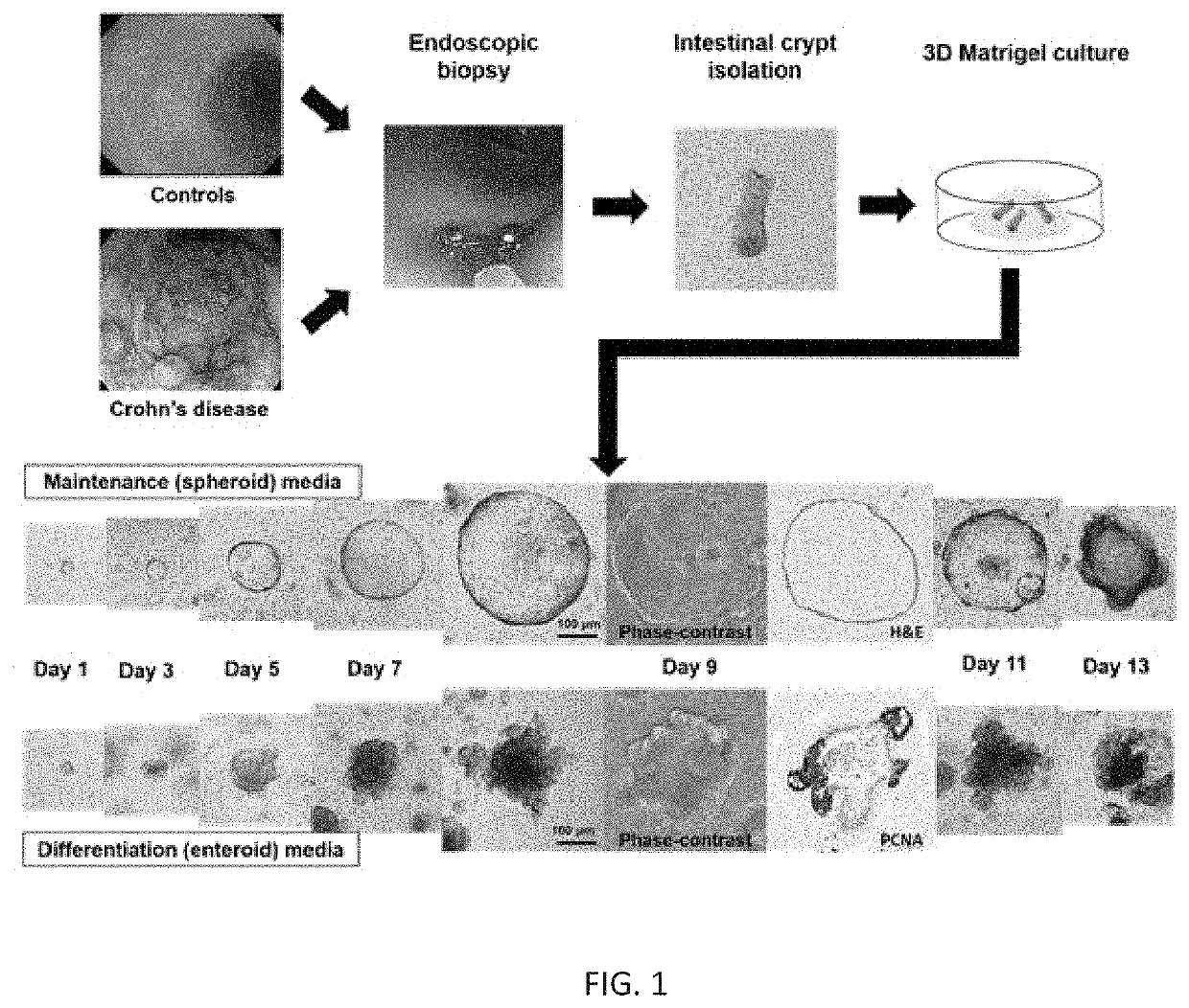 Pharmaceutical composition for preventing or treating inflammatory bowel disease comprising Tumor necrosis factor alpha inhibitor and Prostaglandin E2