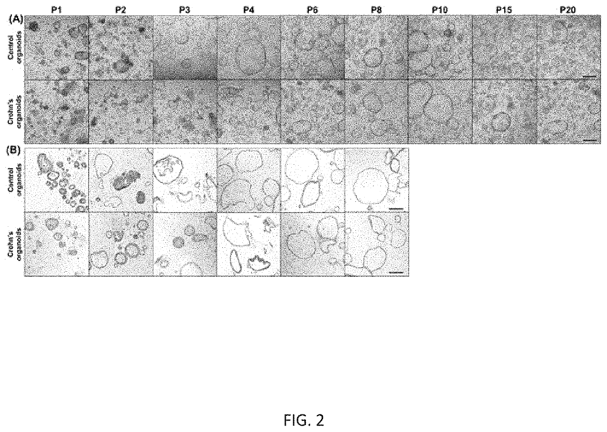Pharmaceutical composition for preventing or treating inflammatory bowel disease comprising Tumor necrosis factor alpha inhibitor and Prostaglandin E2