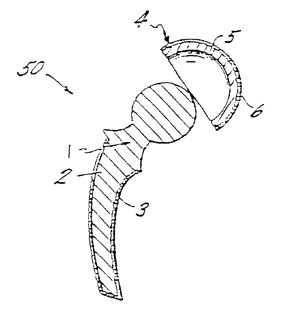 Bone connective prosthesis and method of forming same