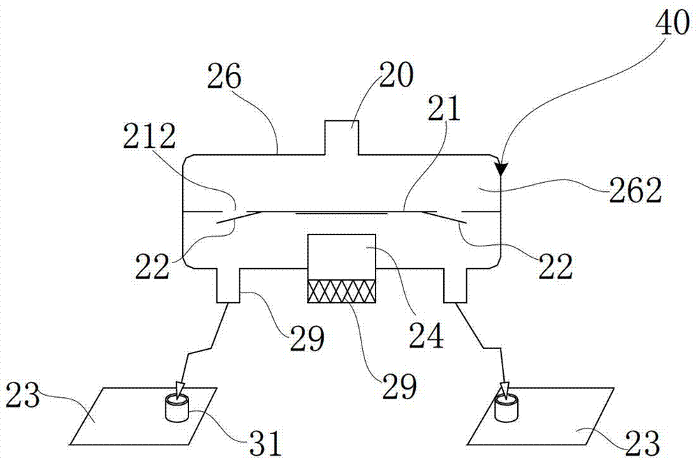 Vehicle-mounted external counterpulsation device