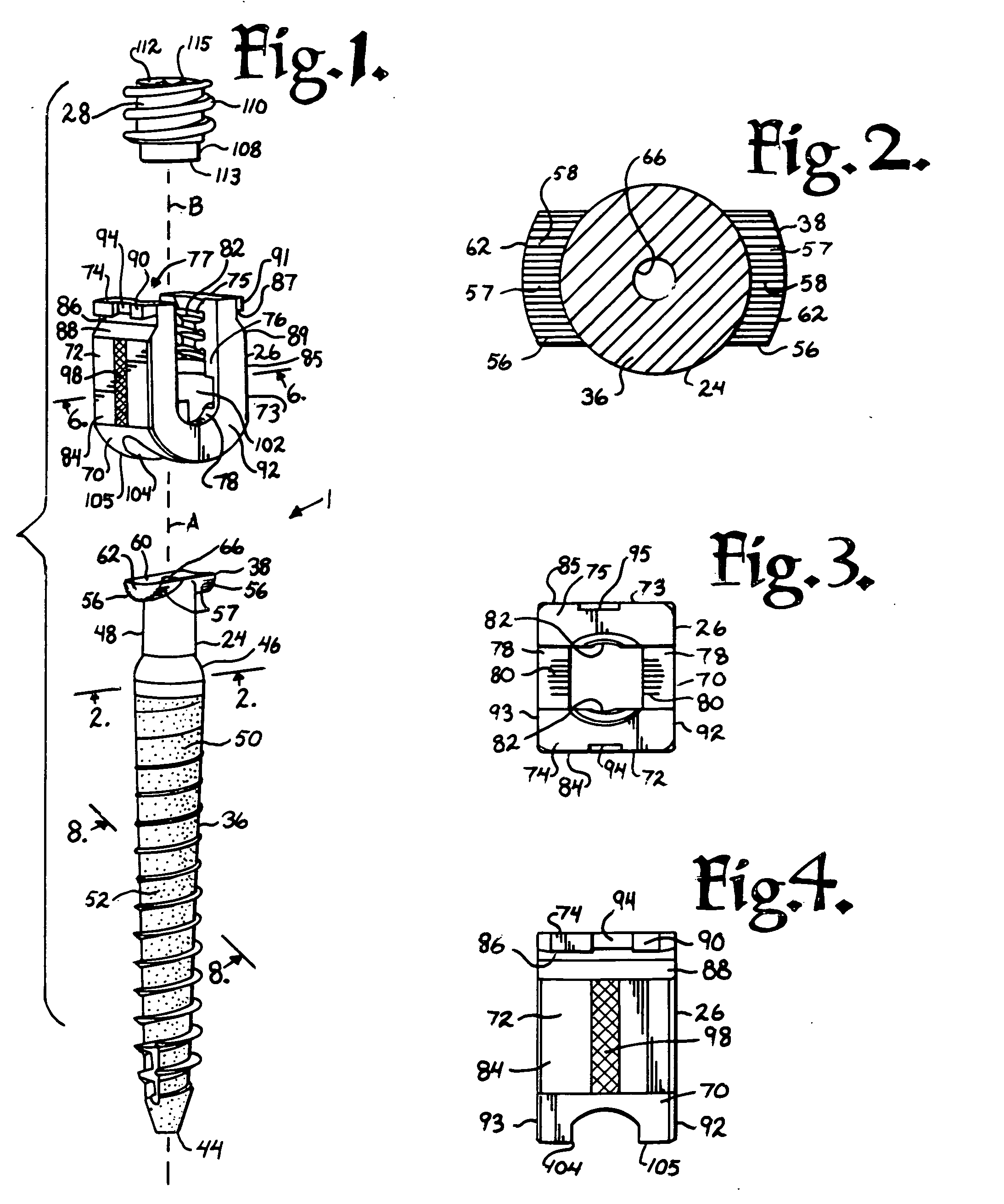 Dynamic stabilization assemblies, tool set and method