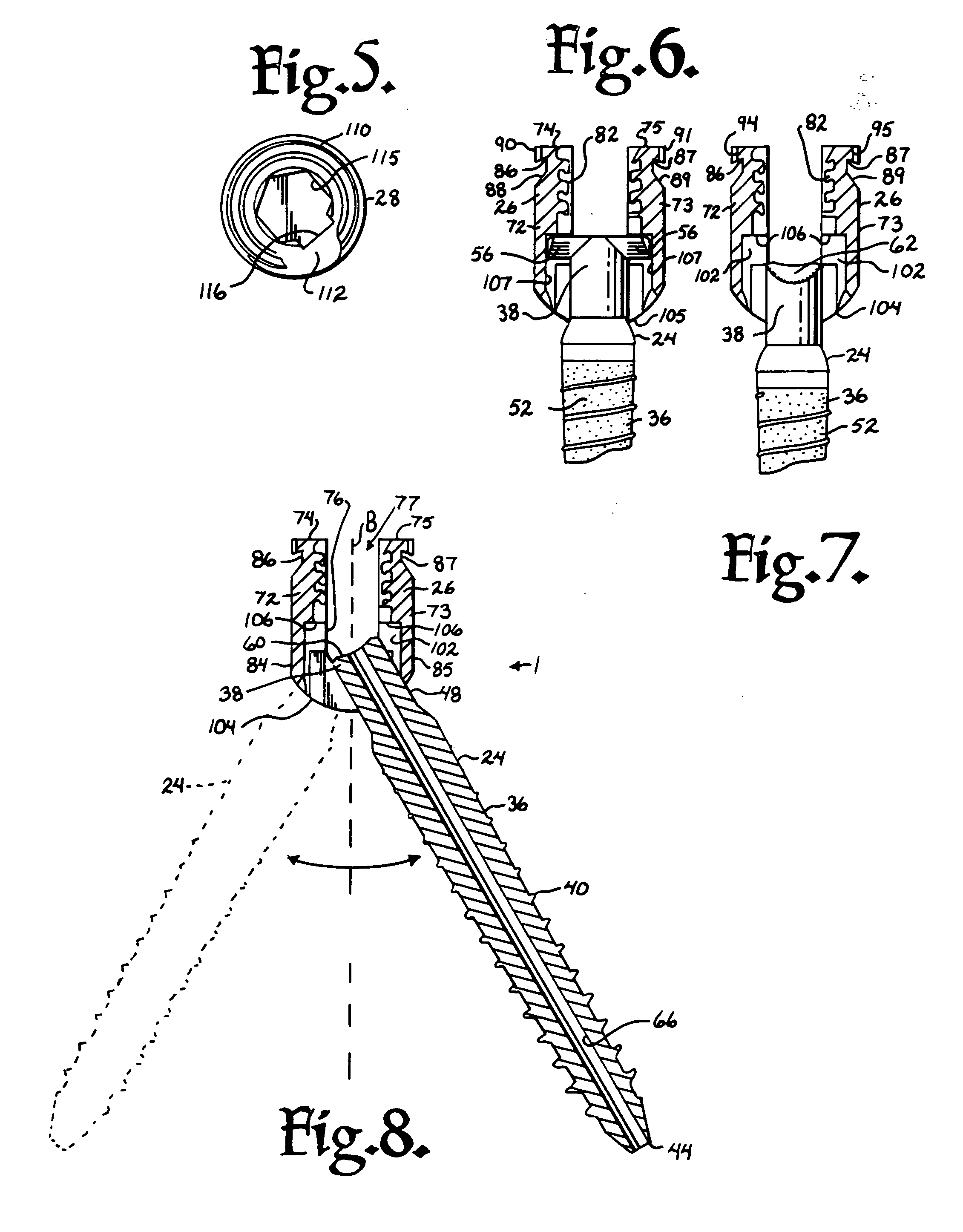 Dynamic stabilization assemblies, tool set and method