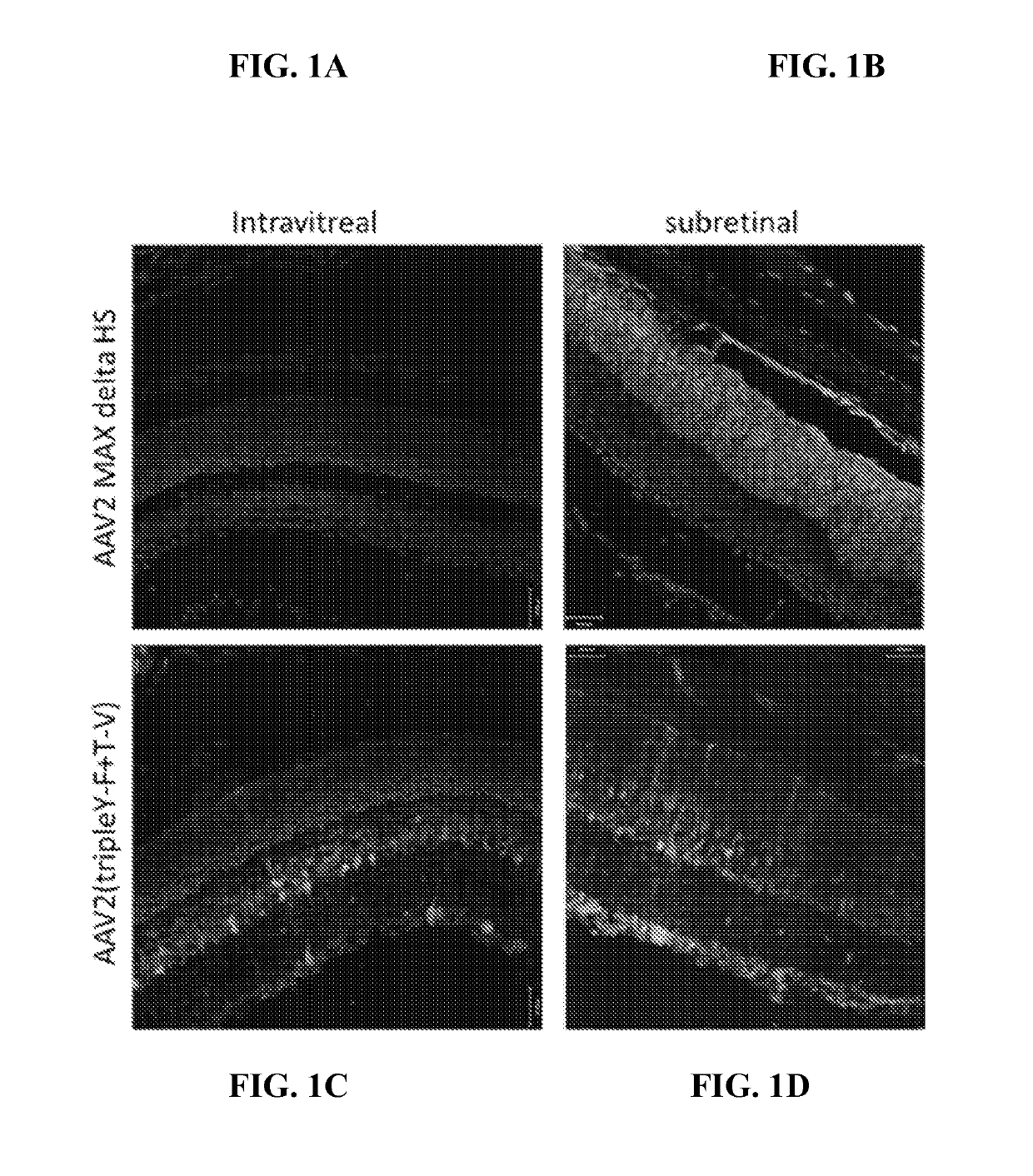 rAAV vectors and methods for transduction of photoreceptors and RPE cells