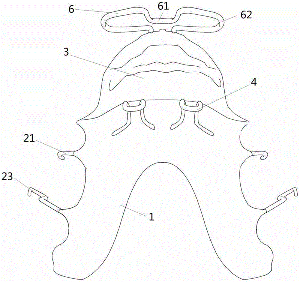 Appliance for guiding mandible forward and/or getting rid of bad habit of sucking lower lip and preparation method thereof