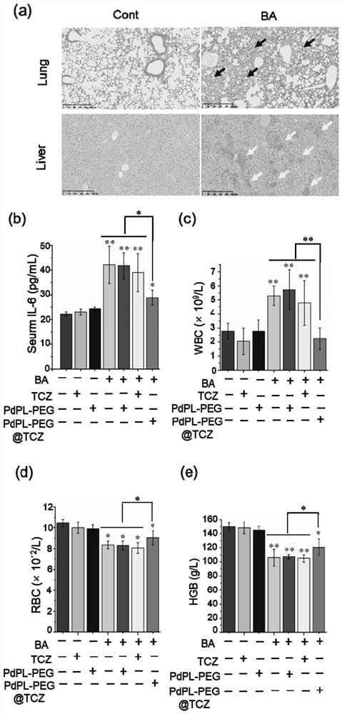 Nano-palladium sheet loaded tuzumab nano-complex, preparation method and application of nano-palladium sheet loaded tuzumab nano-complex in preparation of medicine for treating inflammation-related anemia