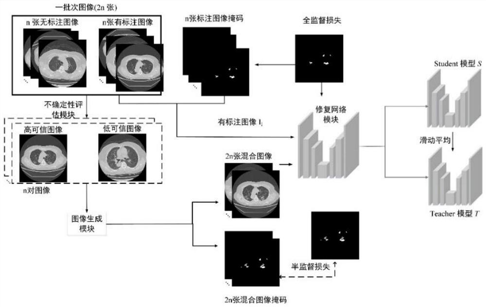 Chest CT image lesion segmentation model training method and system
