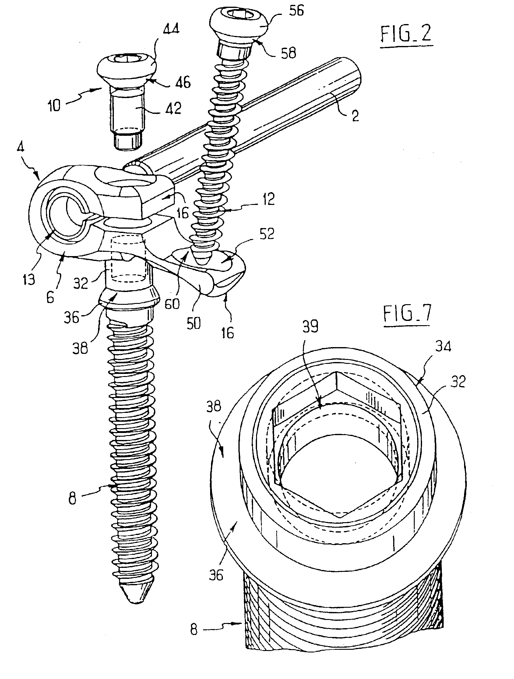 Backbone osteosynthesis system with clamping means in particular for anterior fixing
