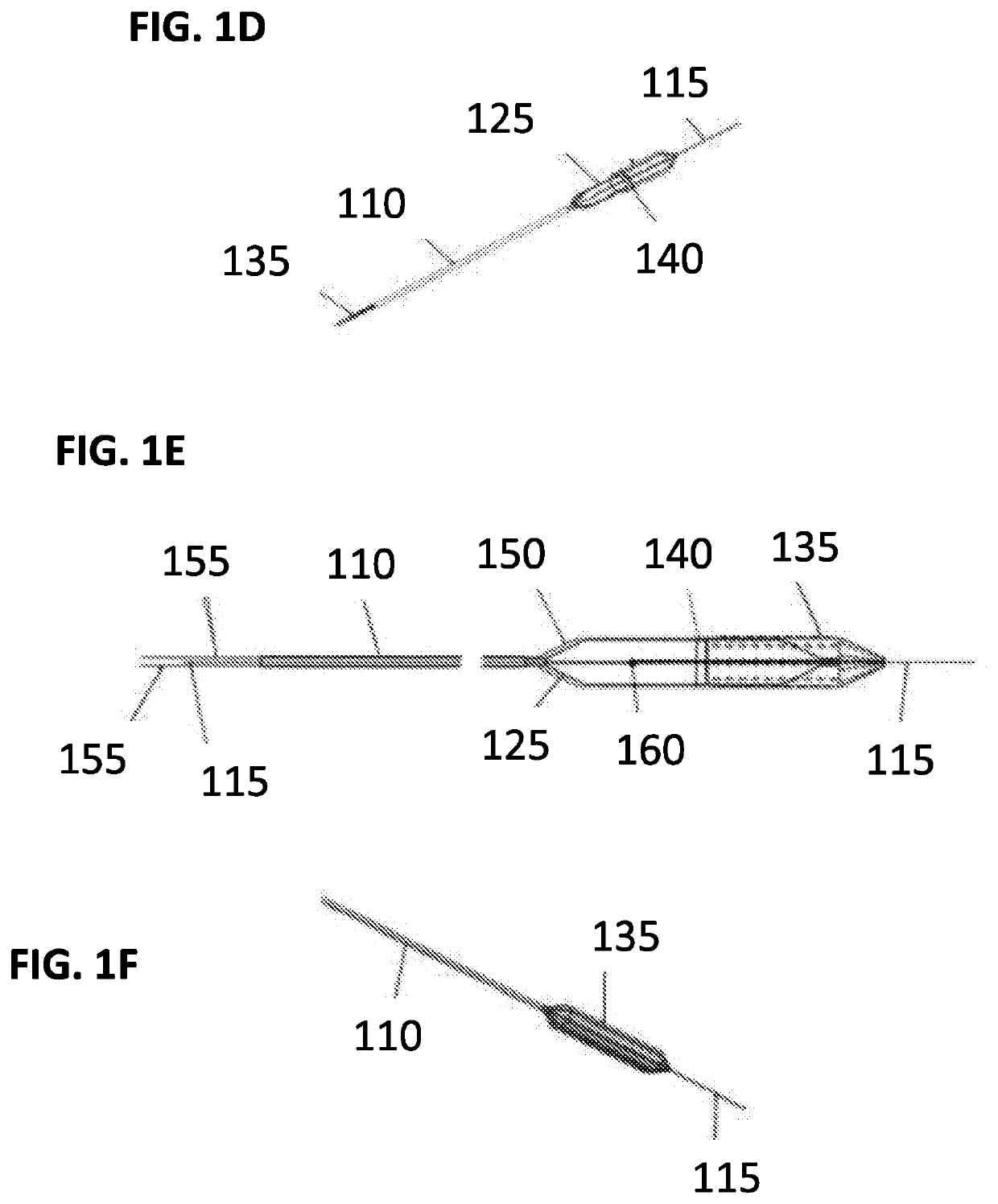 Apparatus and a method for clot and plaque retracting