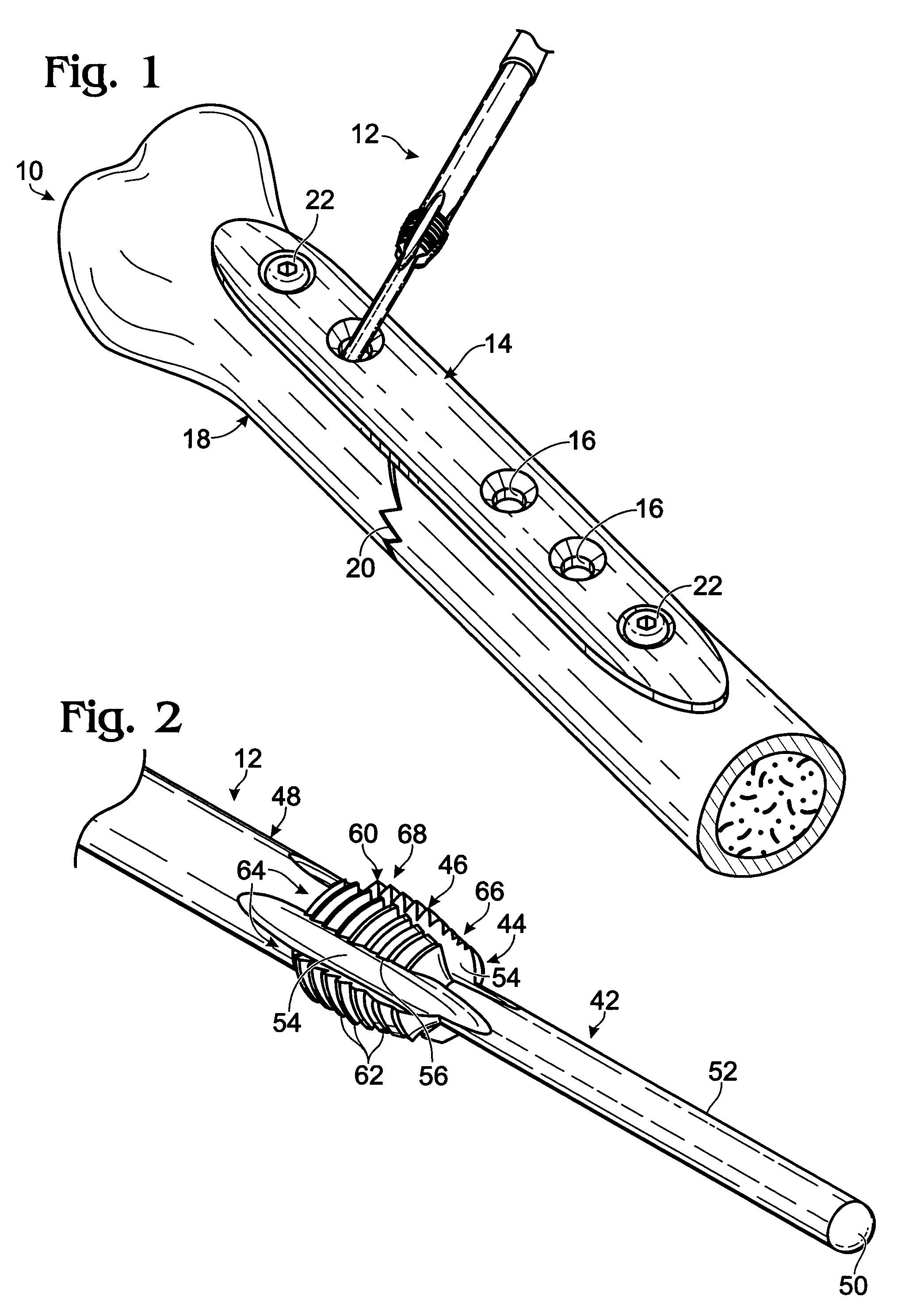 Bone plates with intraoperatively tapped apertures