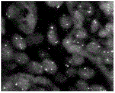 TERC gene and/or MYC gene detection probe, preparation method thereof and reagent kit