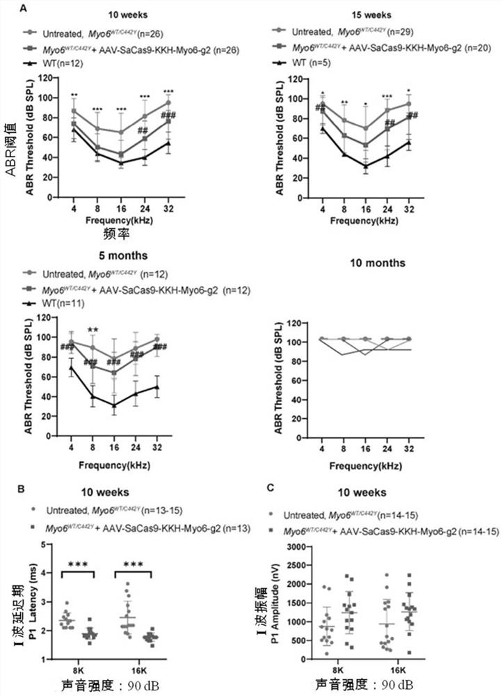 CRISPR/Cas9 gene editing system and application of CRISPR/Cas9 gene editing system in preparation of medicine for treating genetic sensorineural deafness