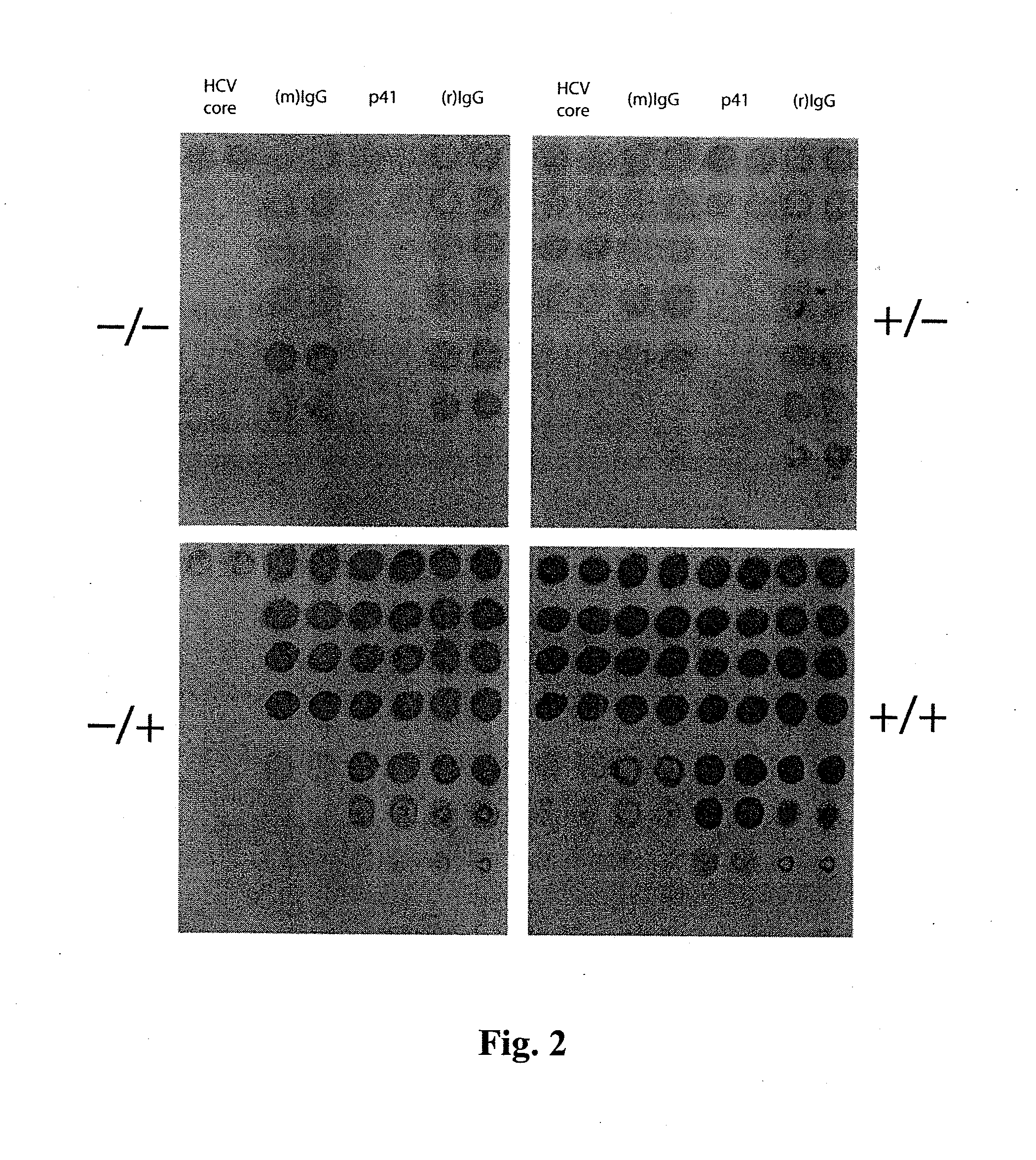 Vertical flow-through devices for multiplexed elisa driven by wicking