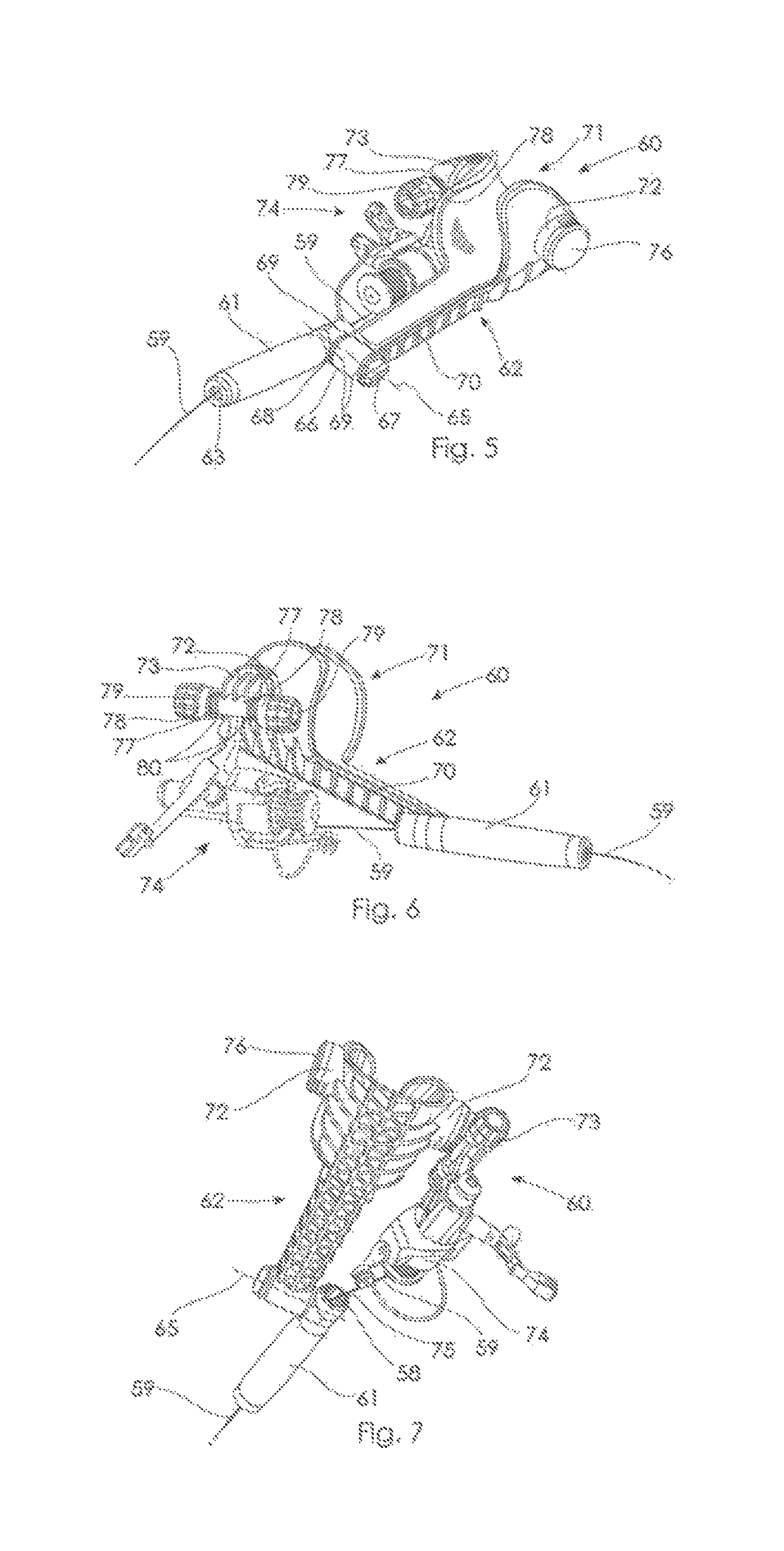 Fishing apparatus