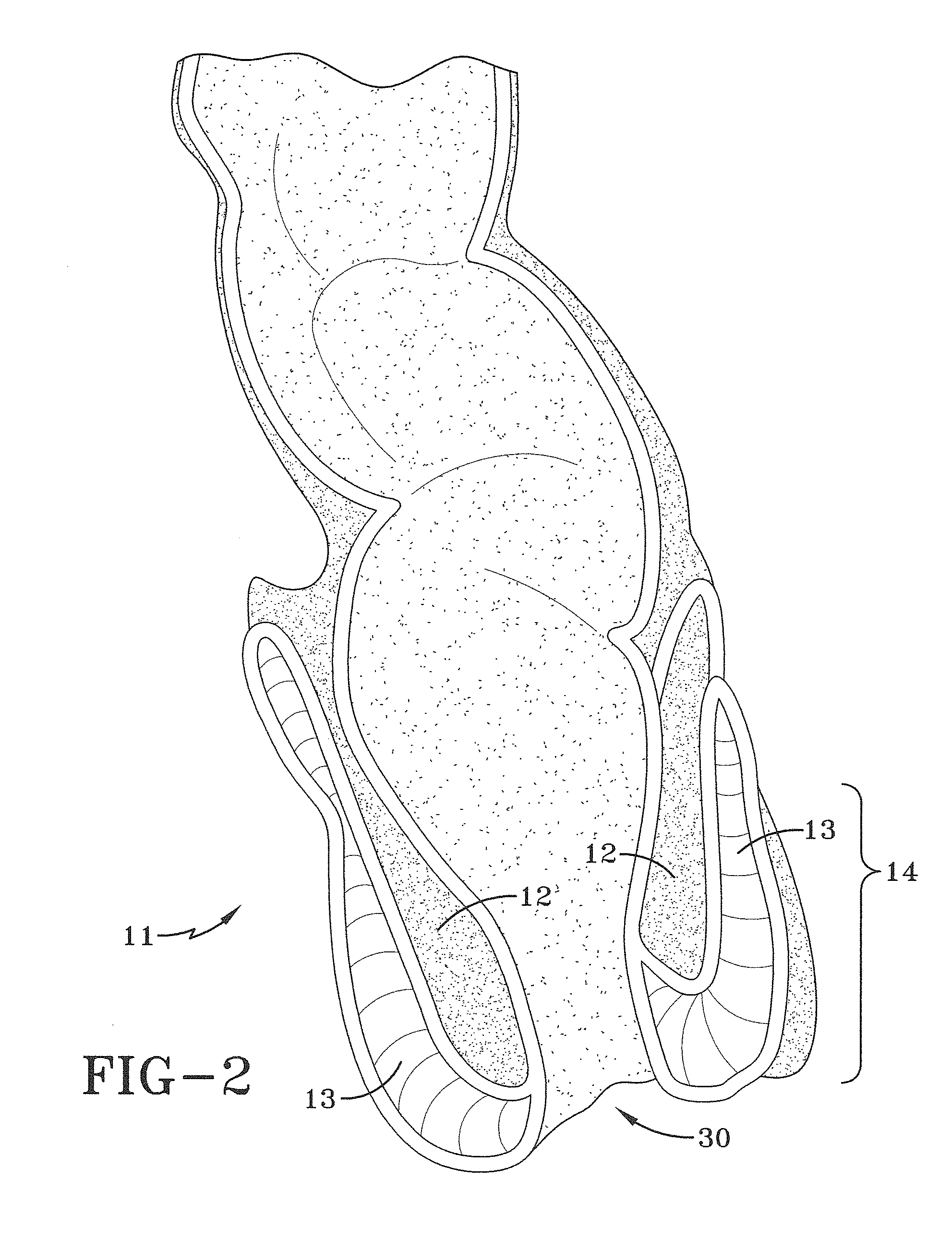 Orifice probe apparatus and a method of use thereof