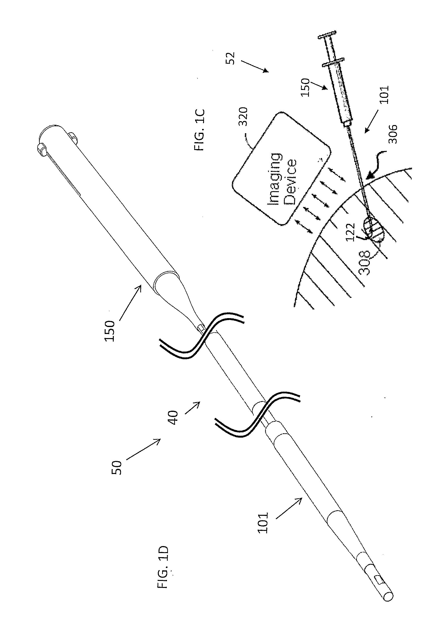Method and system for implant delivery