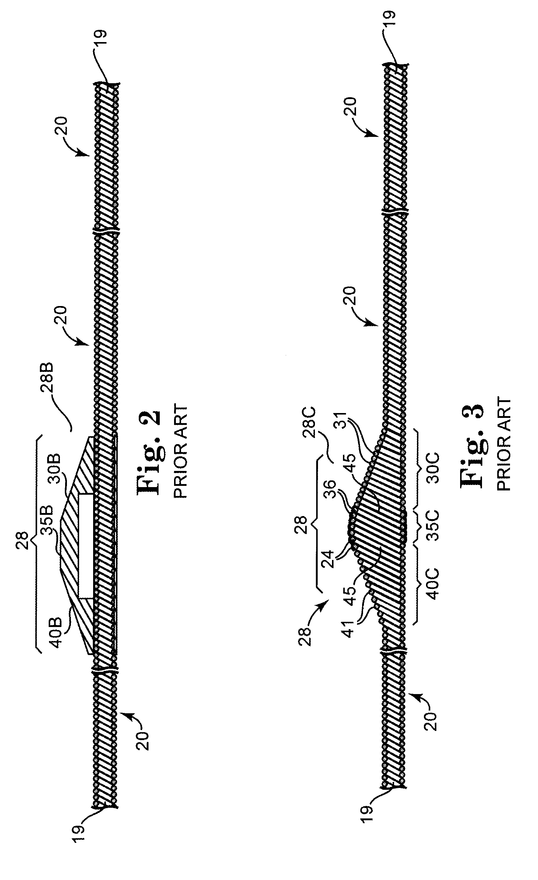 Directional rotational atherectomy device with offset spinning abrasive element