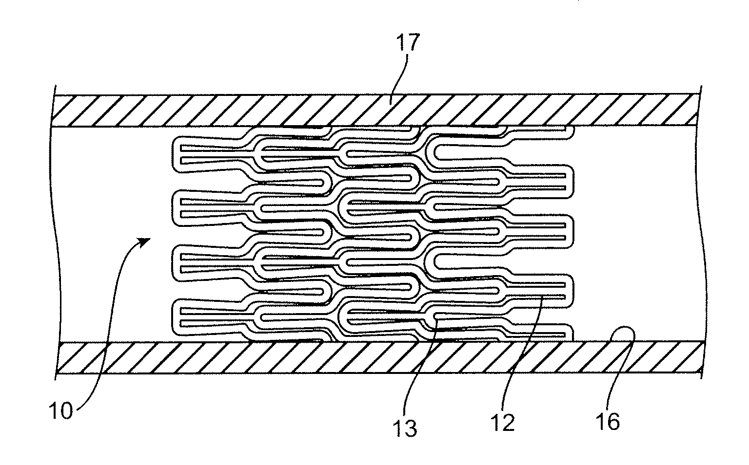 Coated stent and method of making the same
