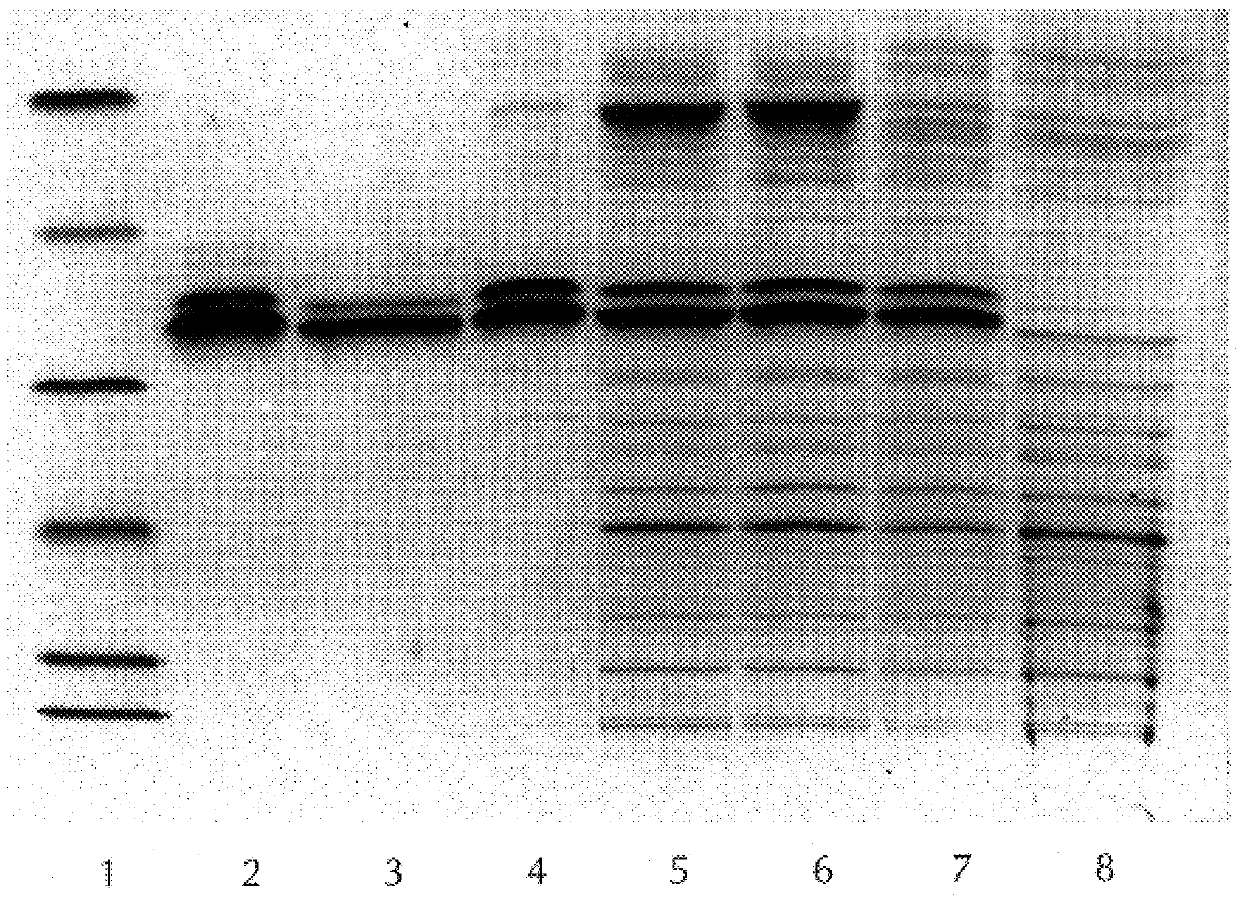 Isolated human cytomegalovirus polypeptides and uses thereof