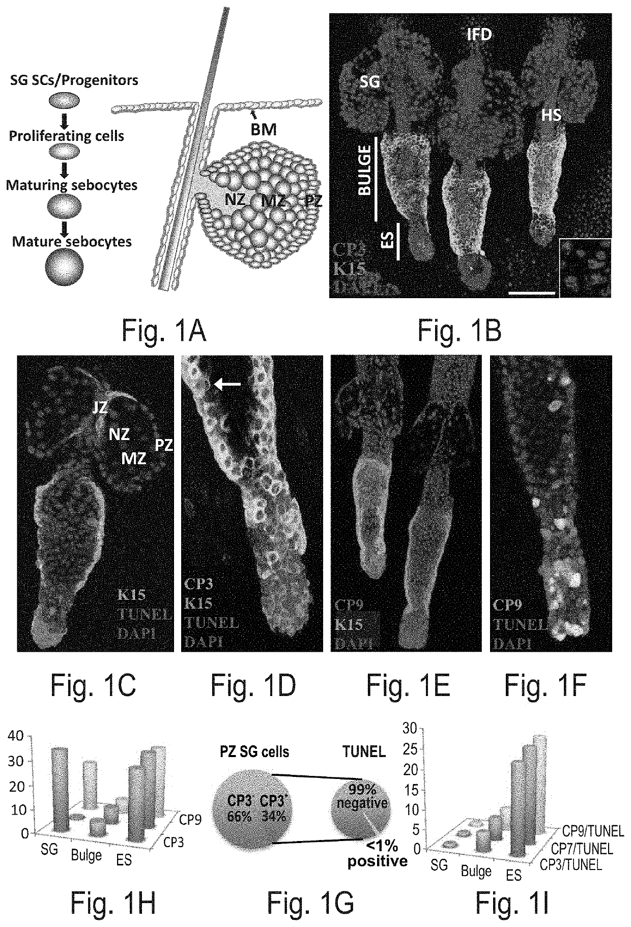 Use of caspase-3 inhibitors and caspase-3 activators in the manufacture of medicament for treating cancer and wound healing