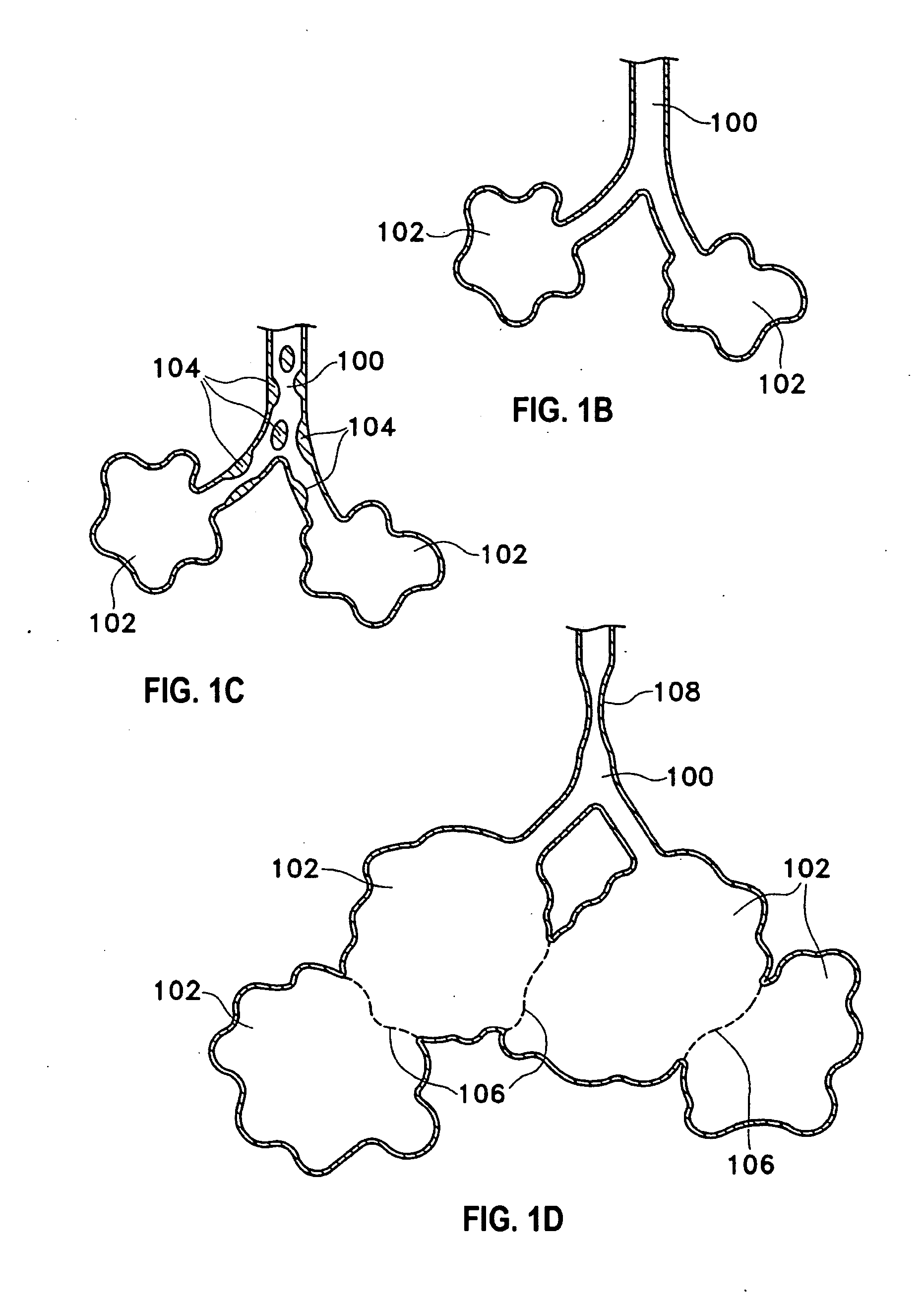 Extrapleural airway device and method
