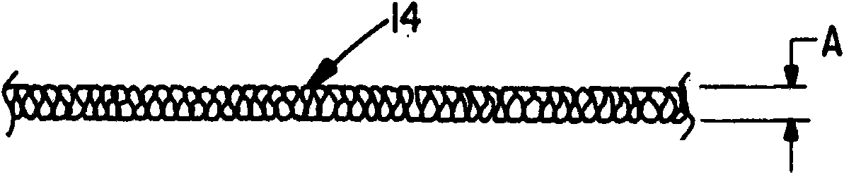 Braided occlusion device having repeating expanded volume segments separated by articulation segments