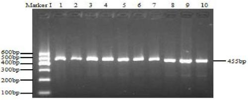 Method for auxiliary detection of growth and carcass traits of cattle by heritable markers of cattle SERPINA3 gene and application thereof