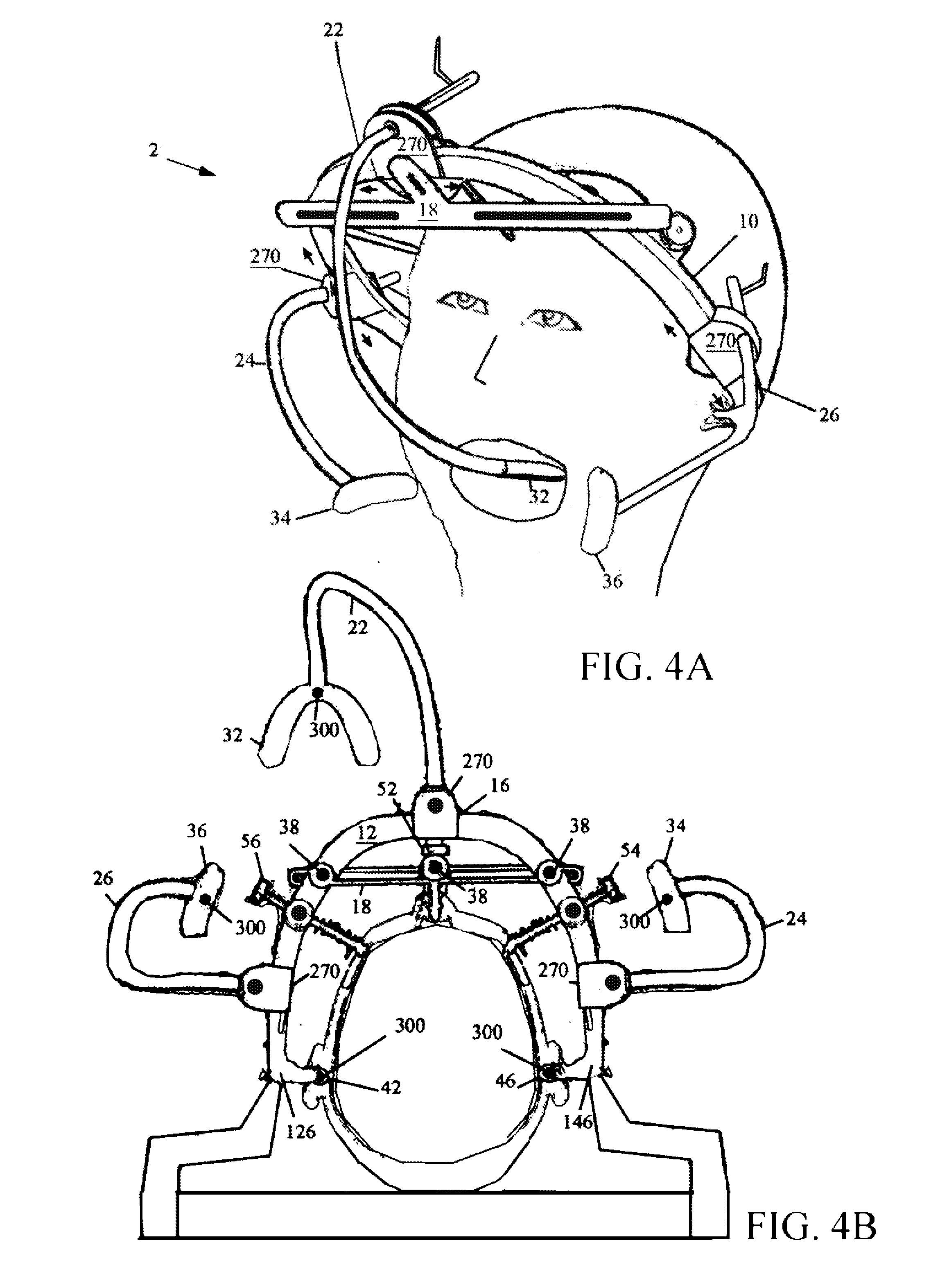 Method and device for positioning and stabilization of bony structures during maxillofacial surgery