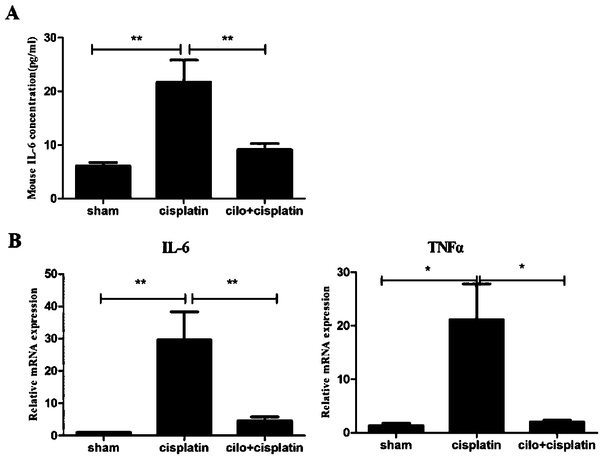 Application of cilomilast in preparation of drug for treating symptoms associated with acute kidney injury