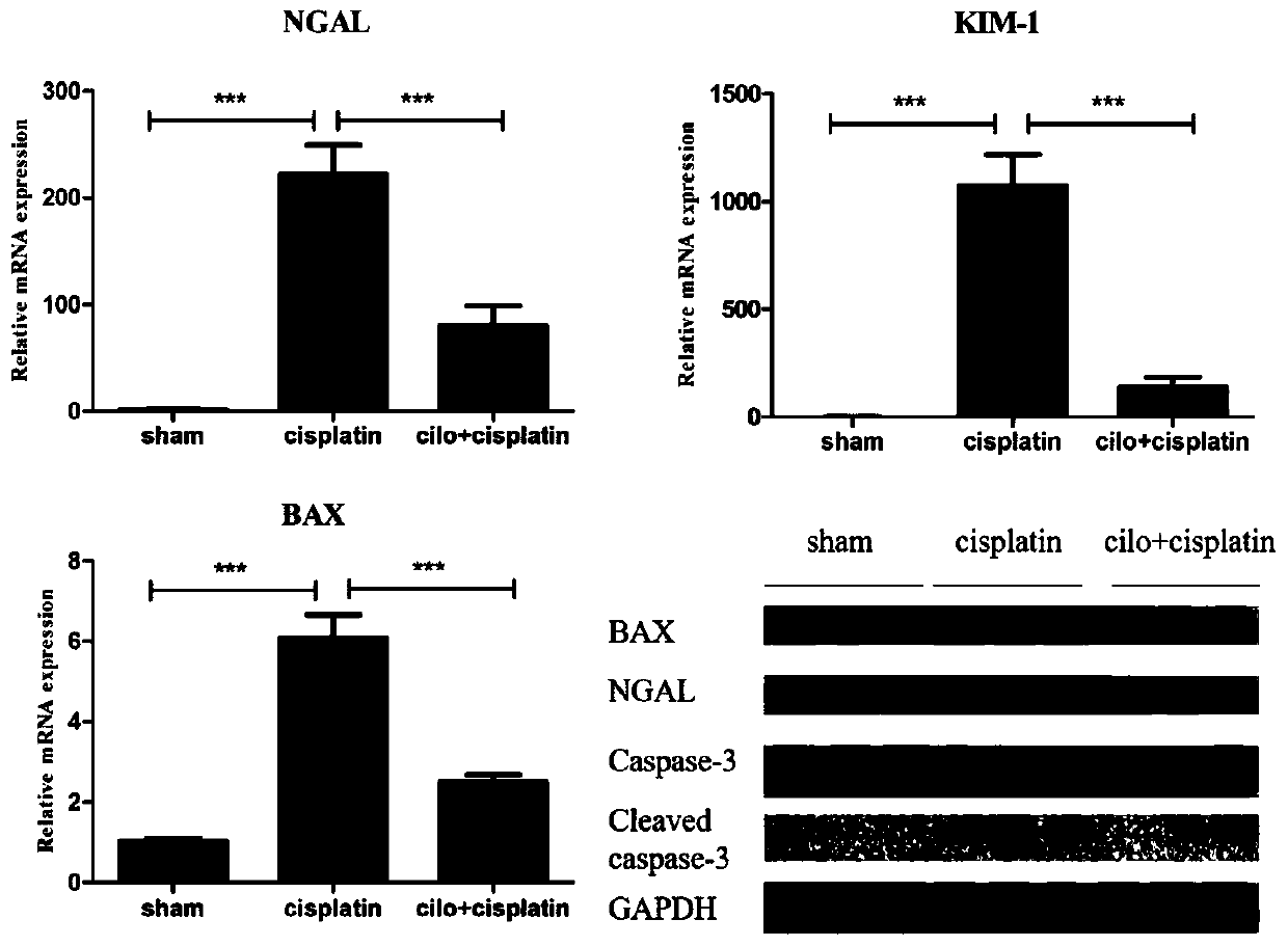 Application of cilomilast in preparation of drug for treating symptoms associated with acute kidney injury