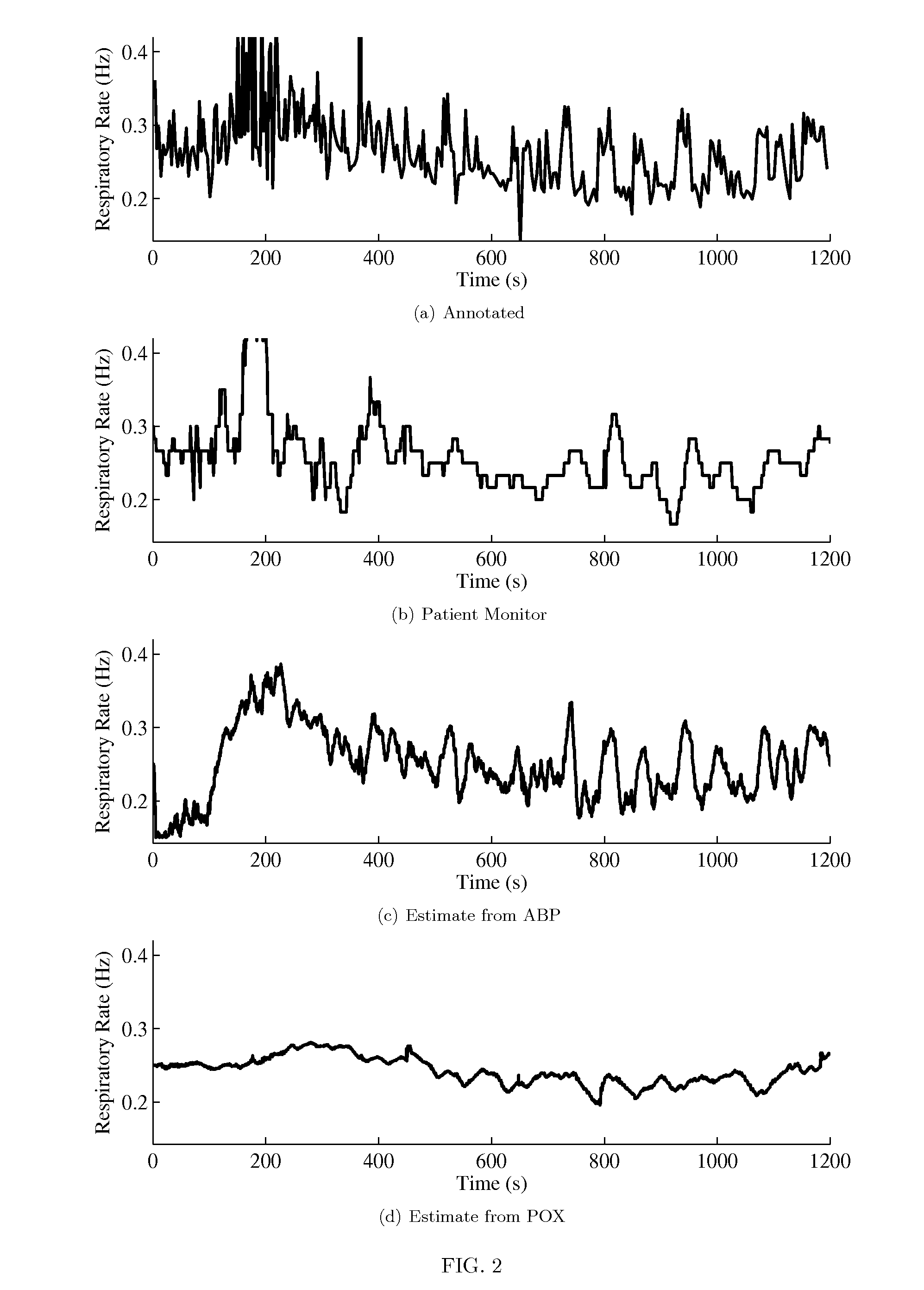 Method, system, and apparatus for cardiovascular signal analysis, modeling, and monitoring