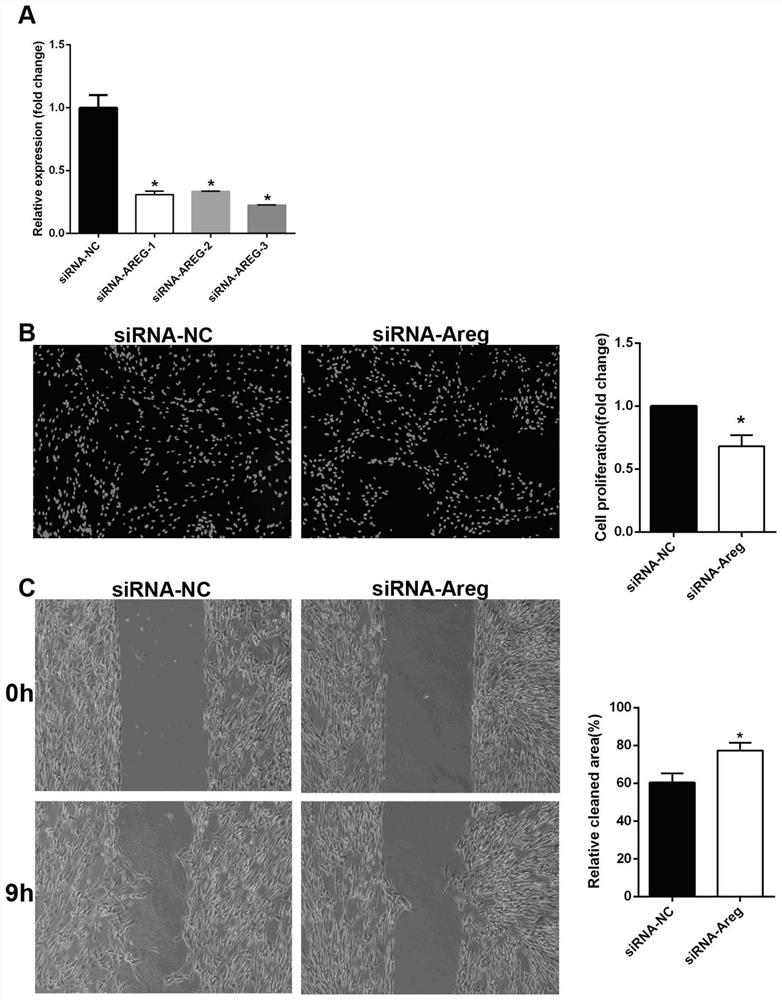 Application of epidermal growth factor Amphiregulin in preparation of Schwann cell regulation drug