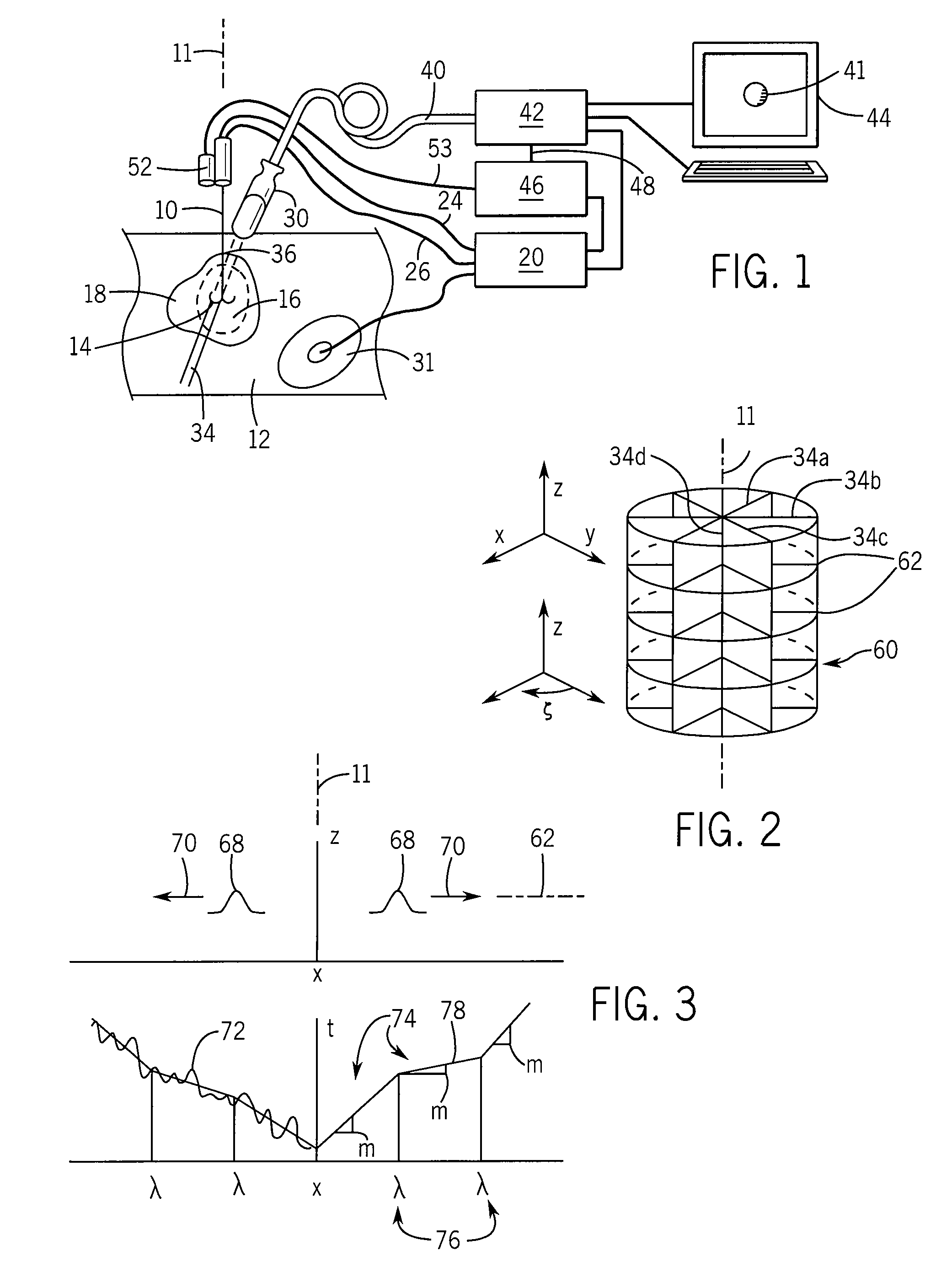 Method and Apparatus for Rapid Acquisition of Elasticity Data in Three Dimensions