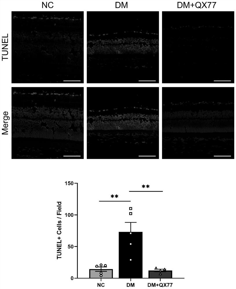 Application of selective autophagy activator QX77 in preparation of medicine for intervening or treating diabetic retinopathy