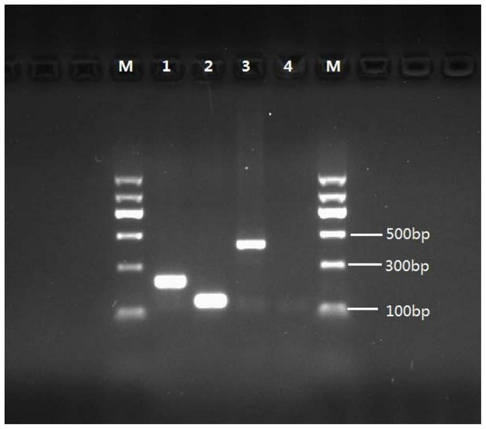 Primer pair combination and kit for detecting and identifying human tissue echinococcosis pathogen