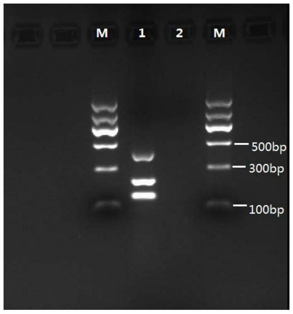 Primer pair combination and kit for detecting and identifying human tissue echinococcosis pathogen