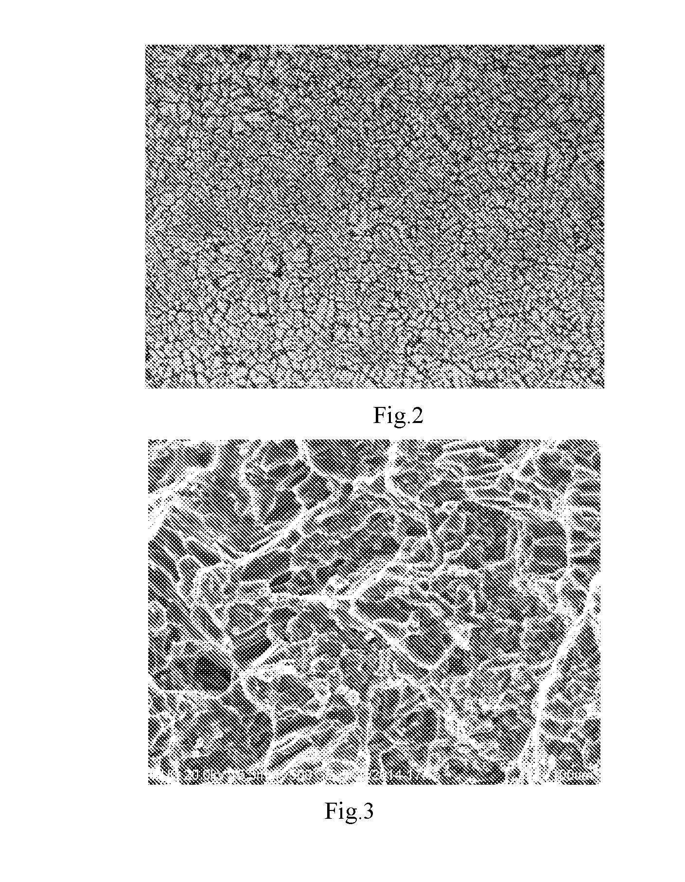 Quasicrystal and alumina mixed particulate reinforced magnesium-based composite material and method for manufacturing the same