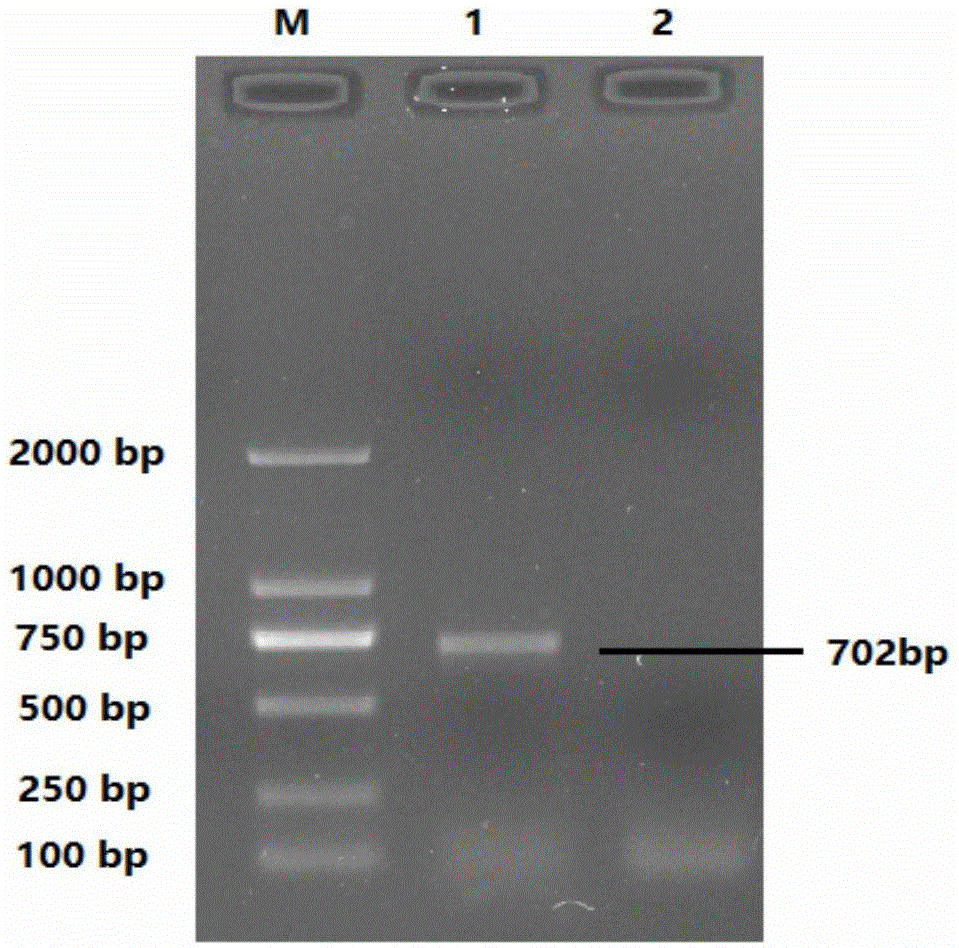 Application of recombinant adenovirus containing porcine circovirus type 2 ORF2 genes as standard sample in nucleic acid amplification testing