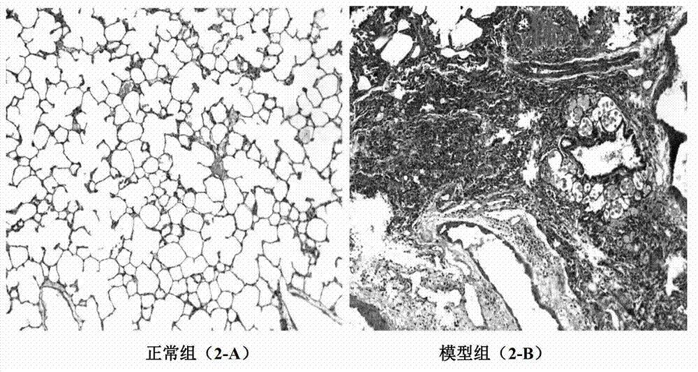 Application of indol-3-carbinol in preparation of medicine for treating experimental pulmonary fibrosis