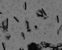 Paenibacillus polymyxa and application thereof in agriculture